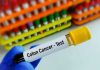 Gloved hand holding colon cancer test tube