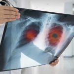 lungs