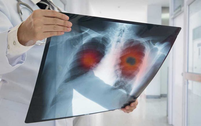 626631452 lungs