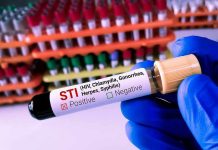AIDS Funding Freeze Sparks NEW Epidemic Panic Gloved hand holding STI test tube labeled Negative.