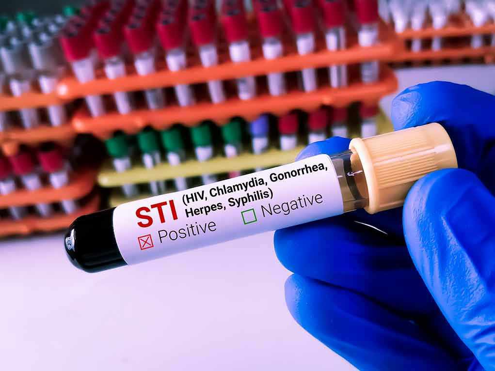Gloved hand holding STI test tube labeled Negative.